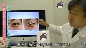 爆料日本医美视频大全集,视频大全集深度解析 第2张 爆料日本医美视频大全集,视频大全集深度解析 第2张